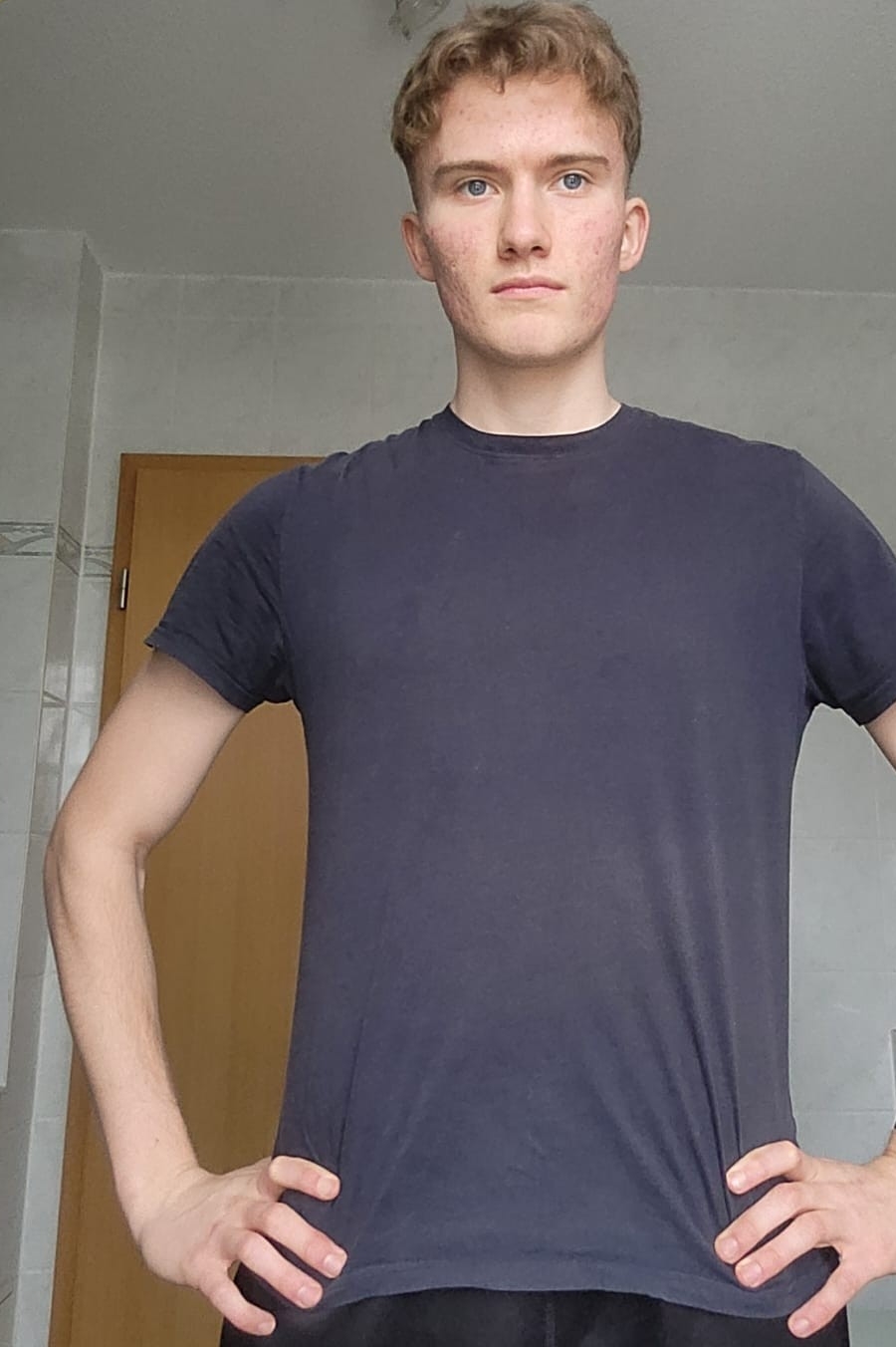 Weiteres Foto von Moritz